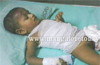 Stray dogs maul 2 yr old boy in Kudroli; victims condition critical